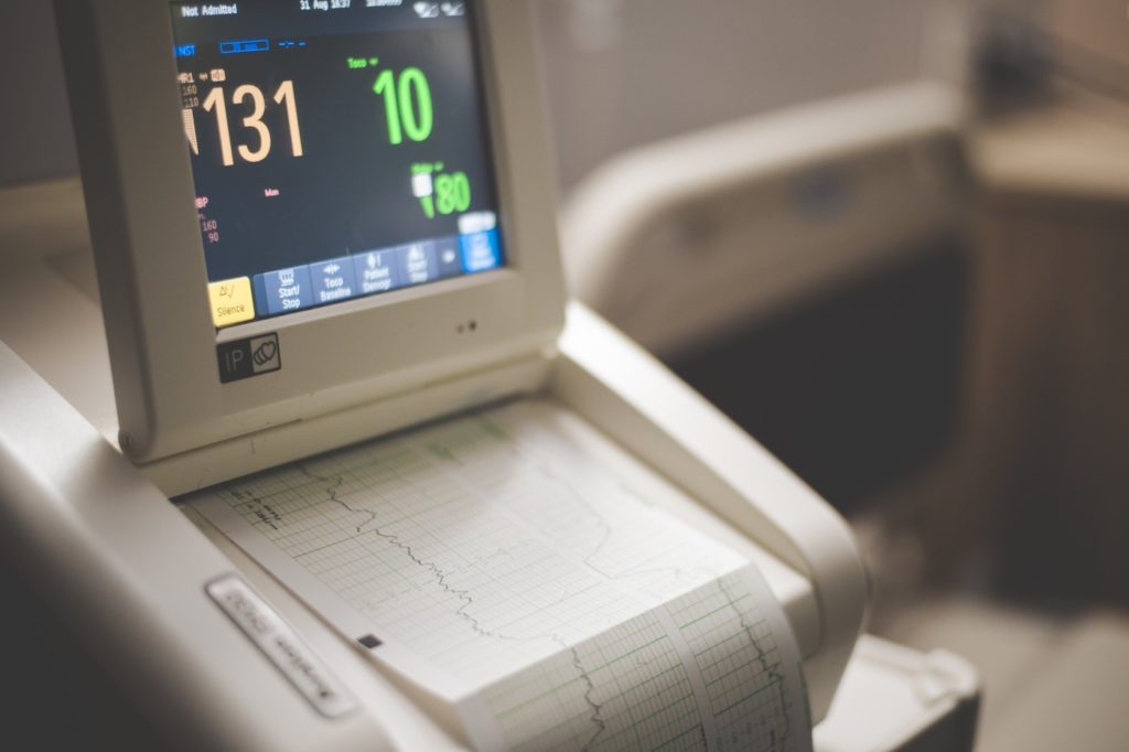 Photo of fetal heartbeat monitoring machine