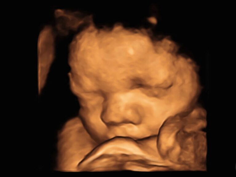 unborn baby